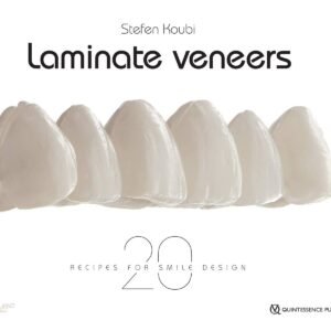 Laminate Veneers 20 Recipes for Smile Design 1st Edition