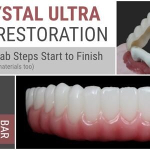 AOX Crystal Ultra Hybrid Restoration – ALL Clinical & Lab Steps Start to Finish