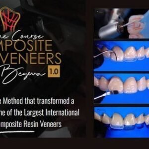 Composite Resin Veneers Course
