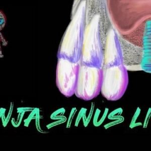 Ninja Sinus Lift Course