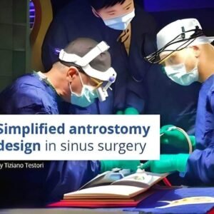 Simplified Antrostomy Design in Maxillary Sinus Surgery