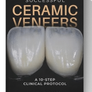 Successful Ceramic Veneers: 10 Steps Clinical Protocol