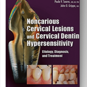 Noncarious Cervical Lesions and Cervical Dentin Hypersensitivity: Etiology, Diagnosis, and Treatment 1st Edition