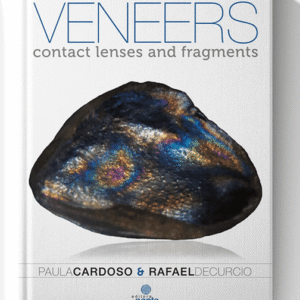 Ceramic Veneers Contact Lenses and Fragments