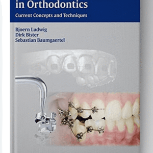 Self-ligating Brackets in Orthodontics: Current Concepts and Techniques 1st Edition