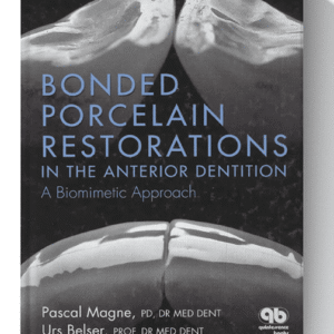 Bonded Porcelain Restorations in the Anterior Dentition: A Biomimetic Approach 1st Edition