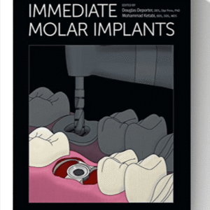 Immediate Molar Implants