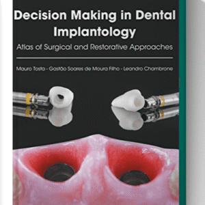 Decision Making in Dental Implantology: Atlas of Surgical and Restorative Approaches 1st Edition
