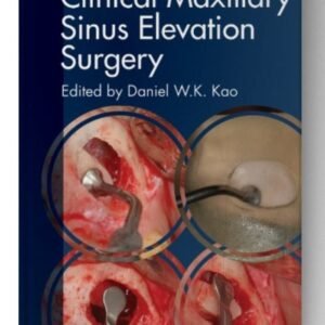 Clinical Maxillary Sinus Elevation Surgery 1st Edition