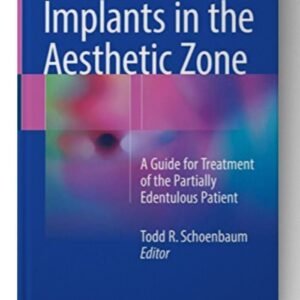 Implants in the Aesthetic Zone: A Guide for Treatment of the Partially Edentulous Patient 1st ed.