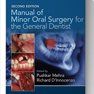 Manual of Minor Oral Surgery for the General Dentist 2nd Edition