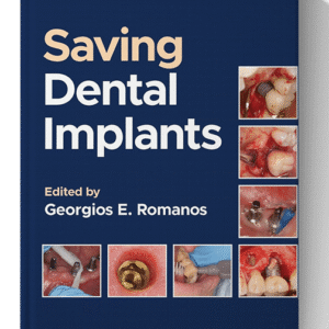 Saving Dental Implants 1st Edition