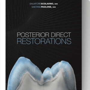 Posterior Direct Restorations 1st Edition